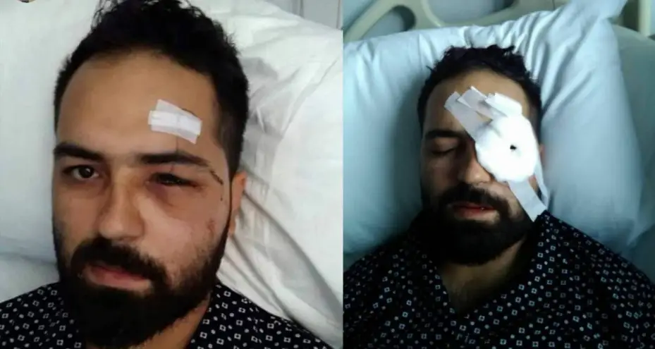 (Düzeltme) 15 Temmuz Gazisi Akkoç: "Darbeci asker dalga geçer bir ses tonu ile ‘sen kelime-i şehadet getir’ dedi"