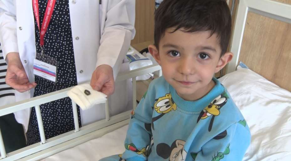 3 yaşındaki çocuğun bağırsağından 7 tane mıknatıs çıktı