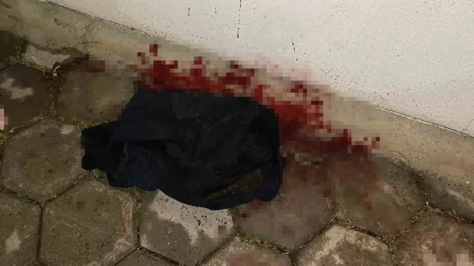 Yan bakma kavgasında 17 yaşındaki çocuk bıçaklandı