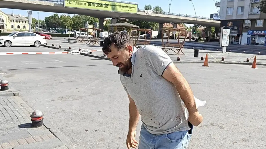 Kayseri’de acemi kasaplar soluğu acil serviste aldı
