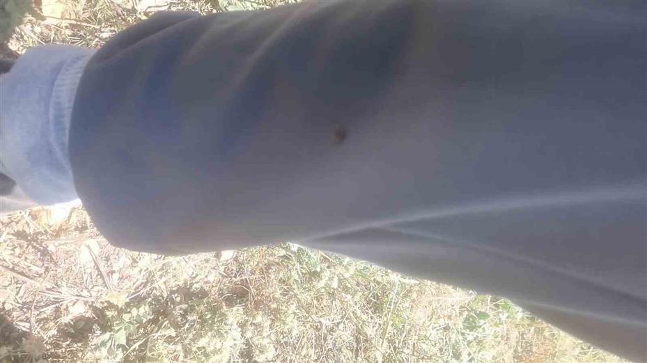 "Keneler, köpekler gibi koku alıp üzerimize geliyor" dedi, o anları kayıt altına aldı