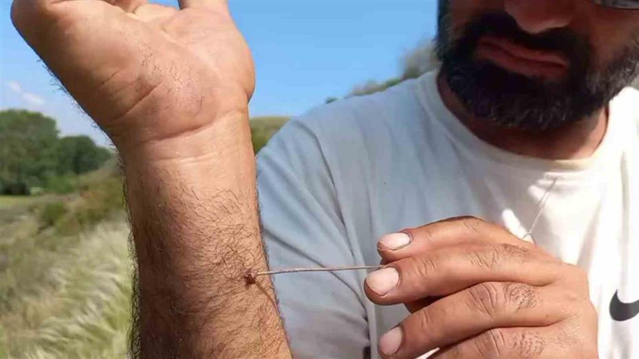 Uzmanı uyardı: "Kenenin vücutta kalma süresi hastalığın bulaşma riskini yükseltiyor"