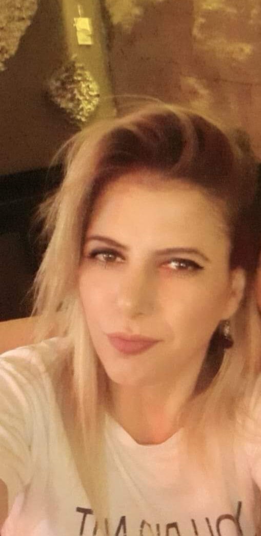 Genç kadının hayatı kezzapla karardı