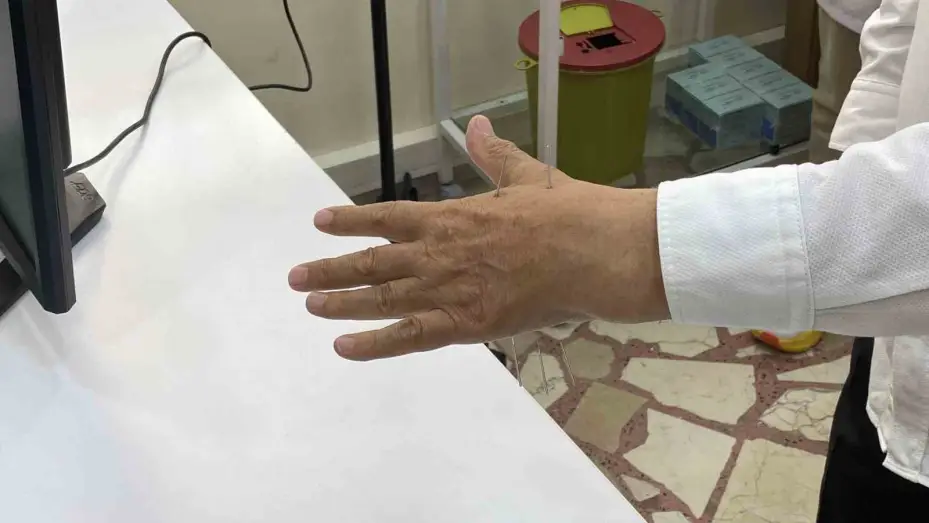 Sağlık ocaklarında akupunktur tedavisi Türkiye’de ilk defa Eskişehir’de uygulandı