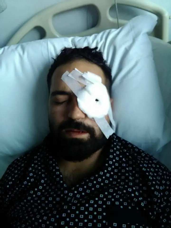 15 Temmuz Gazisi Akkoç: "Darbeci asker dalga geçer bir ses tonu ile ‘sen kelime-i şehadet getir’ dedi"