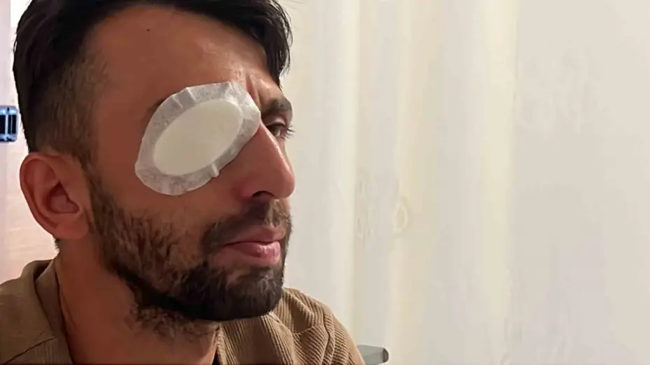 Balkondan açılan ateşte gözünden yaralanan işçi: "Sağ gözümden oldum"