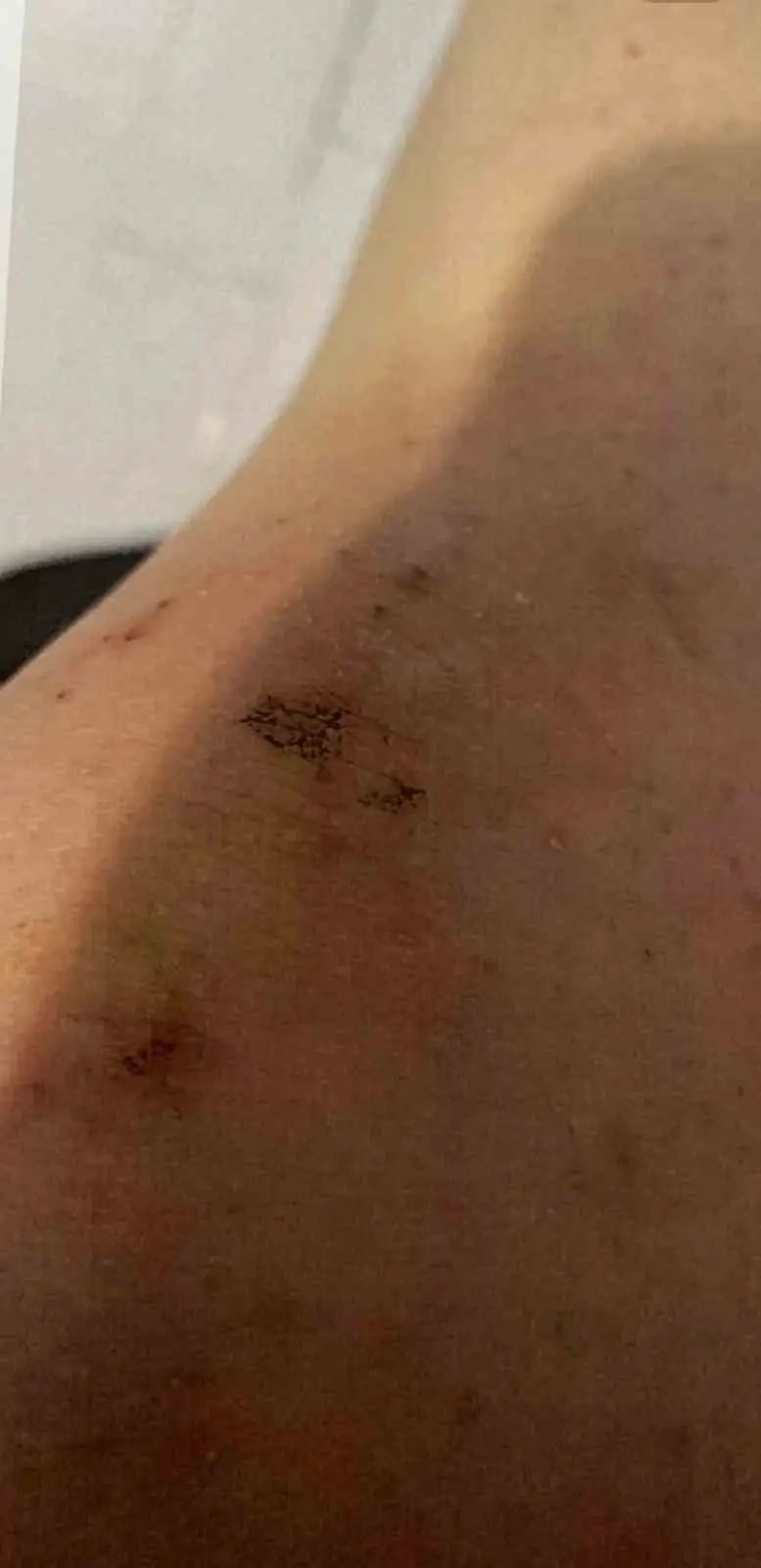 Polis memuru sevgilisi tarafından darp edilen kadın: "Can güvenliğim yok"