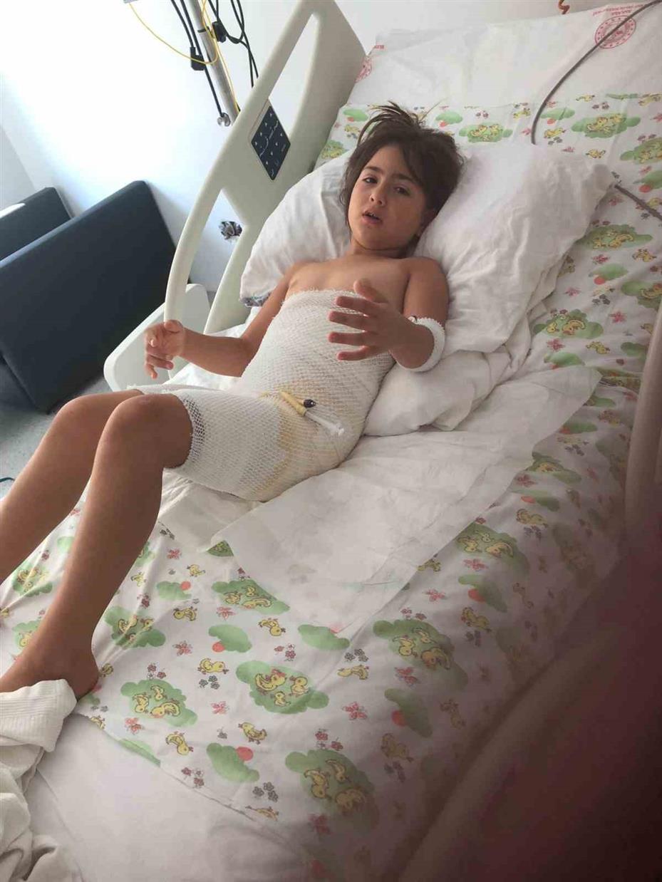 Düğün felaketi oldu: 8 yaşındaki Elif, 7 operasyon geçirdi