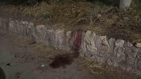 Bıçaklı kavgada 17 yaşındaki çocuk ağır yaralandı