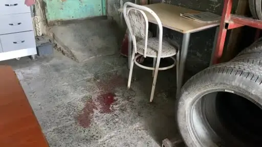 Sandalyeden düşen adam ağır yaralandı