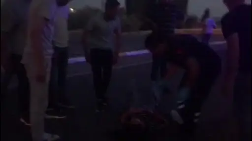 Tofaş’ın çarptığı genç kız yaralandı