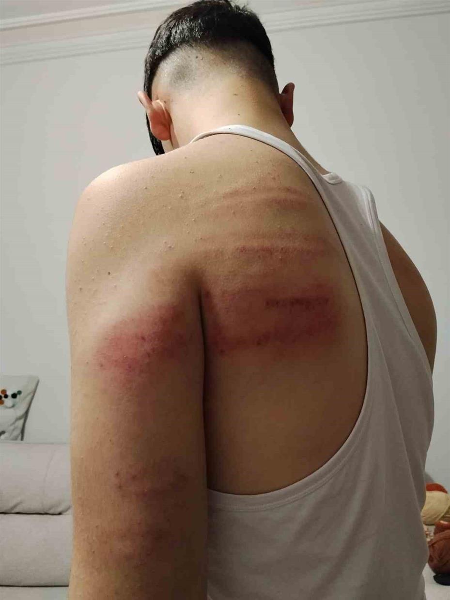 Çırağını darp ettiği iddia edilen berber tutuklandı