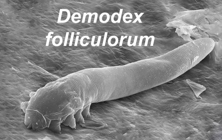 Gözde Yanma, Sulanma ve Kaşıntı Varsa Demodex Parazitine Dikkat !